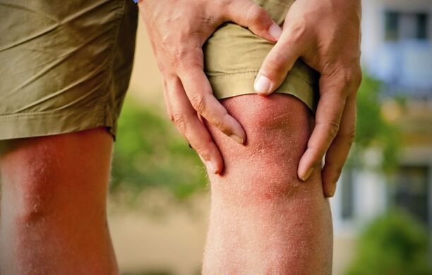 Image clinique de l'arthrose
