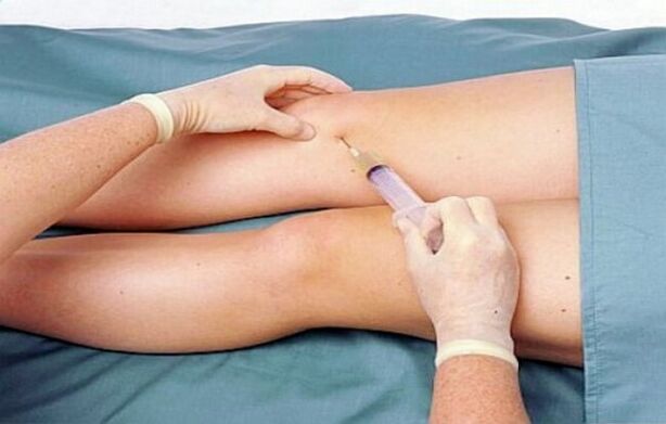 Le degré d'arthrose de l'articulation du genou