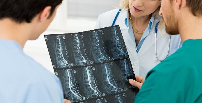 Radiographie de la colonne vertébrale comme méthode de diagnostic de l'ostéochondrose